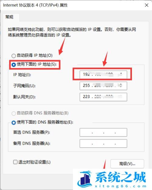 Win11,以太网,IP配置步骤